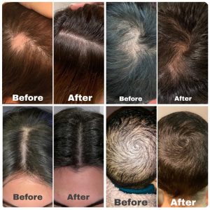 برخی از نتایج واقعی استفاده از پاستیل هیرتامین - منبع سایت اصلی Hairtamin